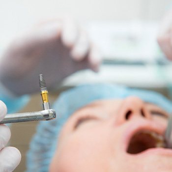 Closeup of dental implant about to be surgically placed