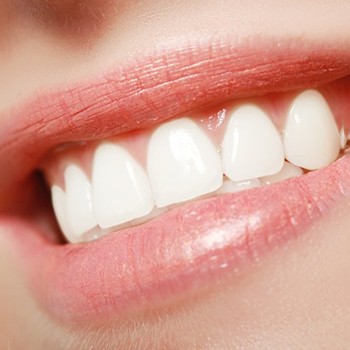 a person smiling while undergoing the veneer process